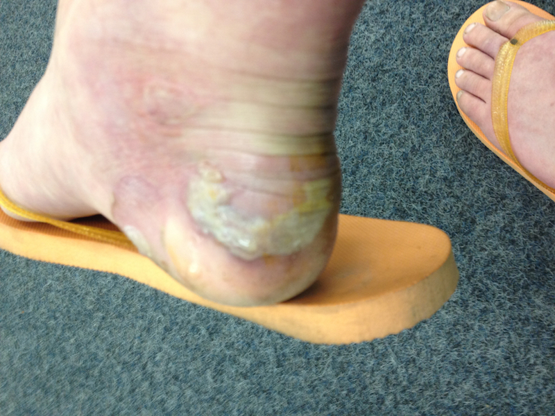 10+ Desert Shoes Mens Tips For Blister Free Hikes